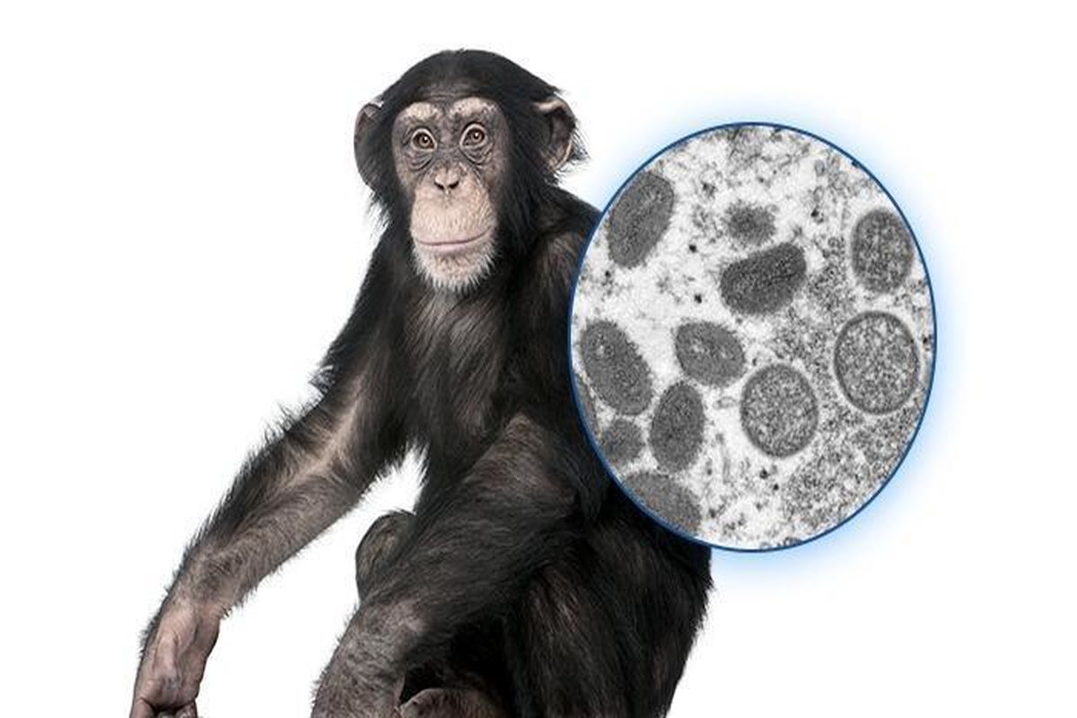 گسترش آبله میمون و افزایش تدابیر بهداشتی در امارات