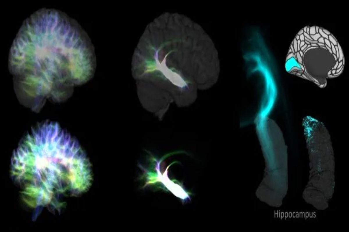 اسب دریایی ؛ جدید ترین نقشه کشف شده از مغز 